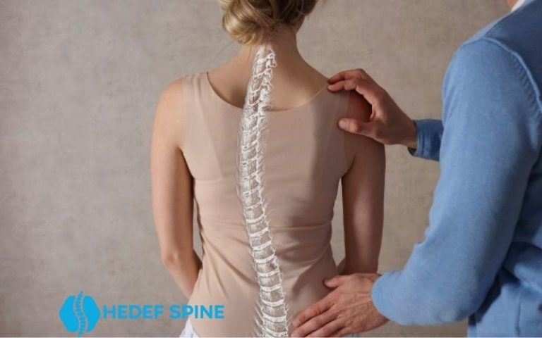 Skolyoz Korsesi İle Sağlığınızı Destekleyin